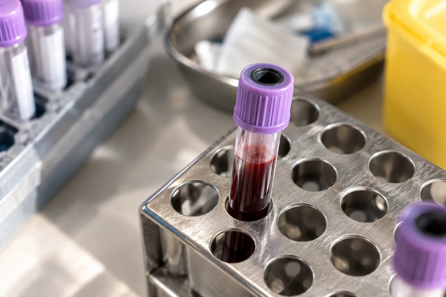 Hémoglobine glyquée : bien préparer son bilan de suivi glycémique